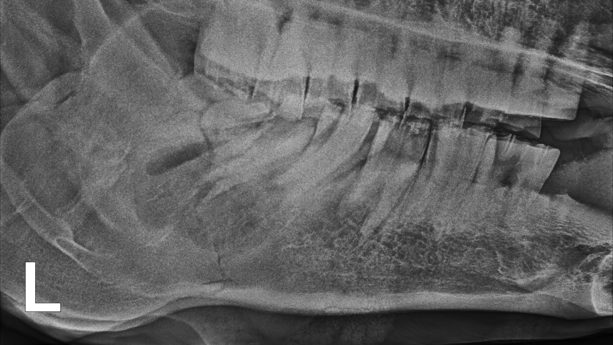Röntgen Pferdezähne
